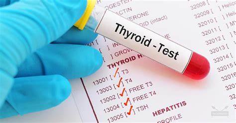 Thyroid Tests